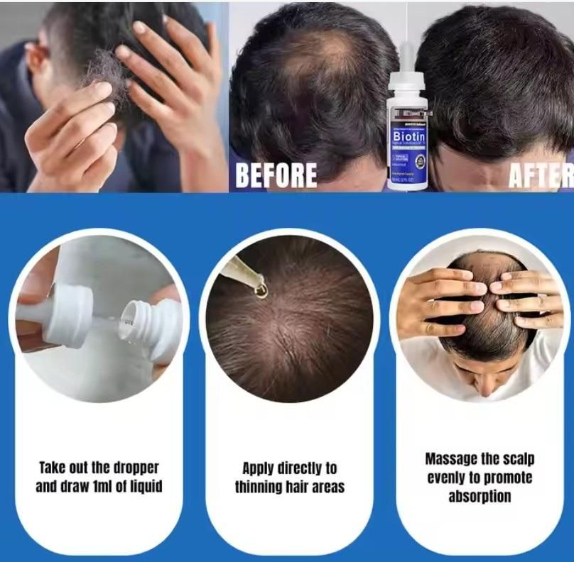 Biotin Serum Advance Hair Regrowth Treatment 60ml